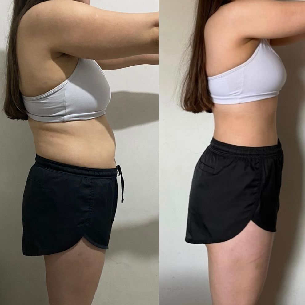 Antes y después - 30 días de uso